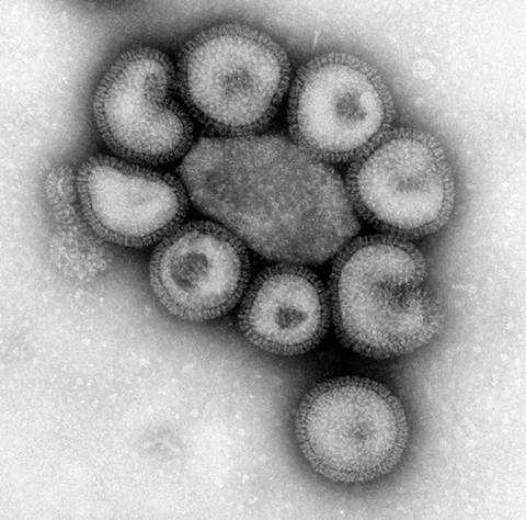 Microscopic image of flu. 9 circular shaped virus cells are visible in black and white.
