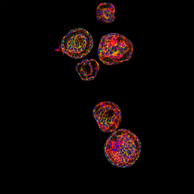 A visualizatin of a pancreas.